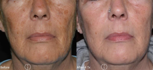 Dermatologist Near Me In Rutherford & Verona | Geria Dermatology in NJ