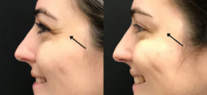 Dermatologist Near Me In Rutherford & Verona | Geria Dermatology in NJ