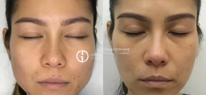 Dermatologist Near Me In Rutherford & Verona | Geria Dermatology in NJ